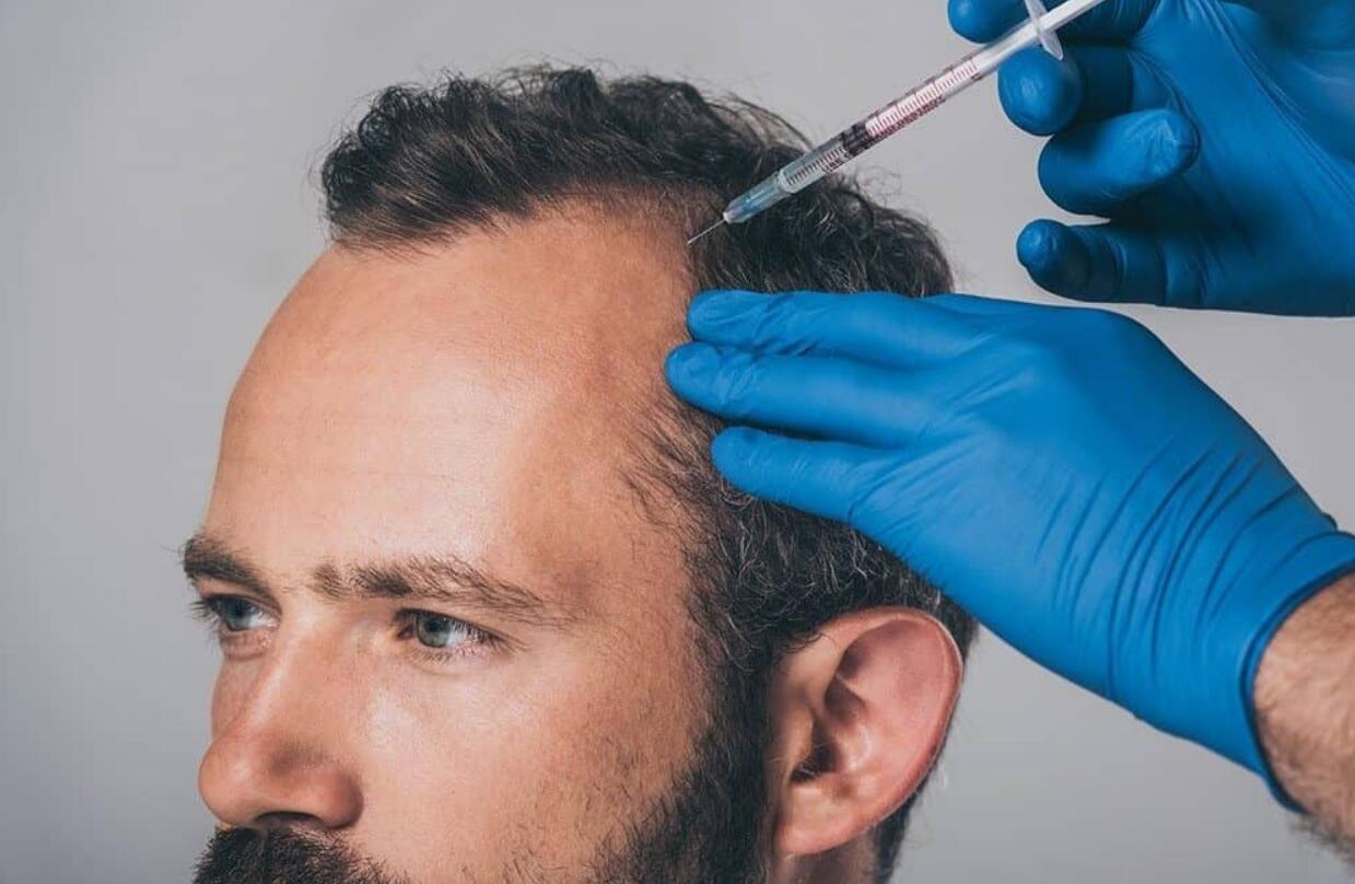 Ways to Avoid Hair Loss: Your Guide for Smooth Scalps - Hairstyles Weekly