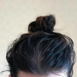Greasy Hair